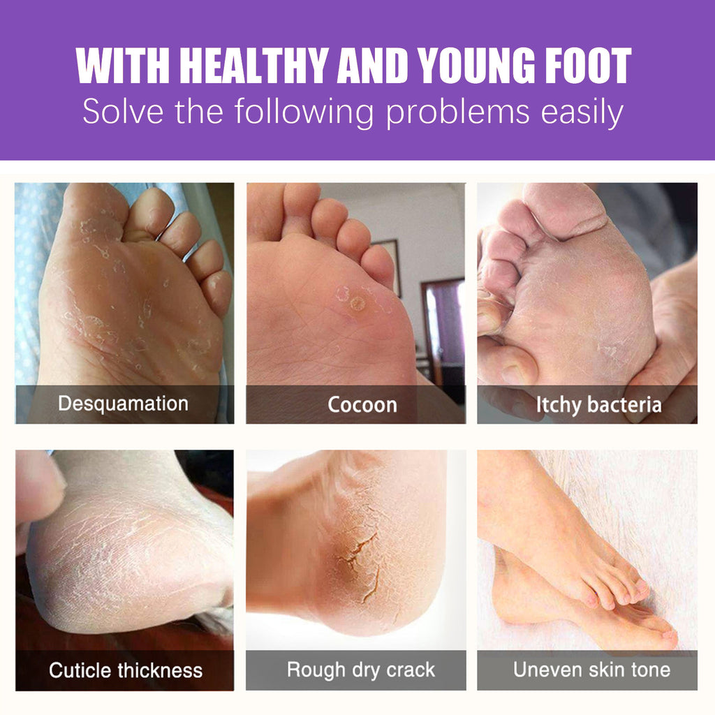 EELHOE Ginger Foot Mask (Bag) Foot Moisturizing, Nourishing, Rejuvenating, Exfoliating, Removing Dead Skin, Dry And Cracked Skin Care Foot Mask